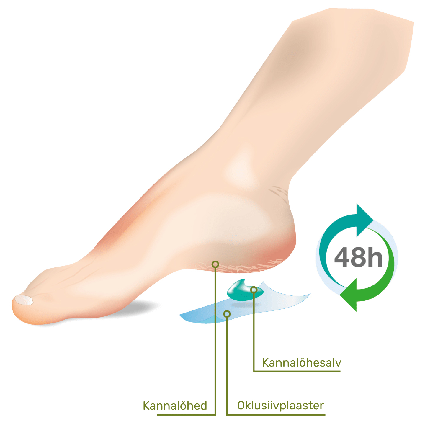 Peaaegu kõik meist on kunagi kogenud jalgadel tüütuid survepunkte. Nendest tekkinud nahamuutused ei ole mitte ainult visuaalselt häirivad, vaid võivad olla ka t